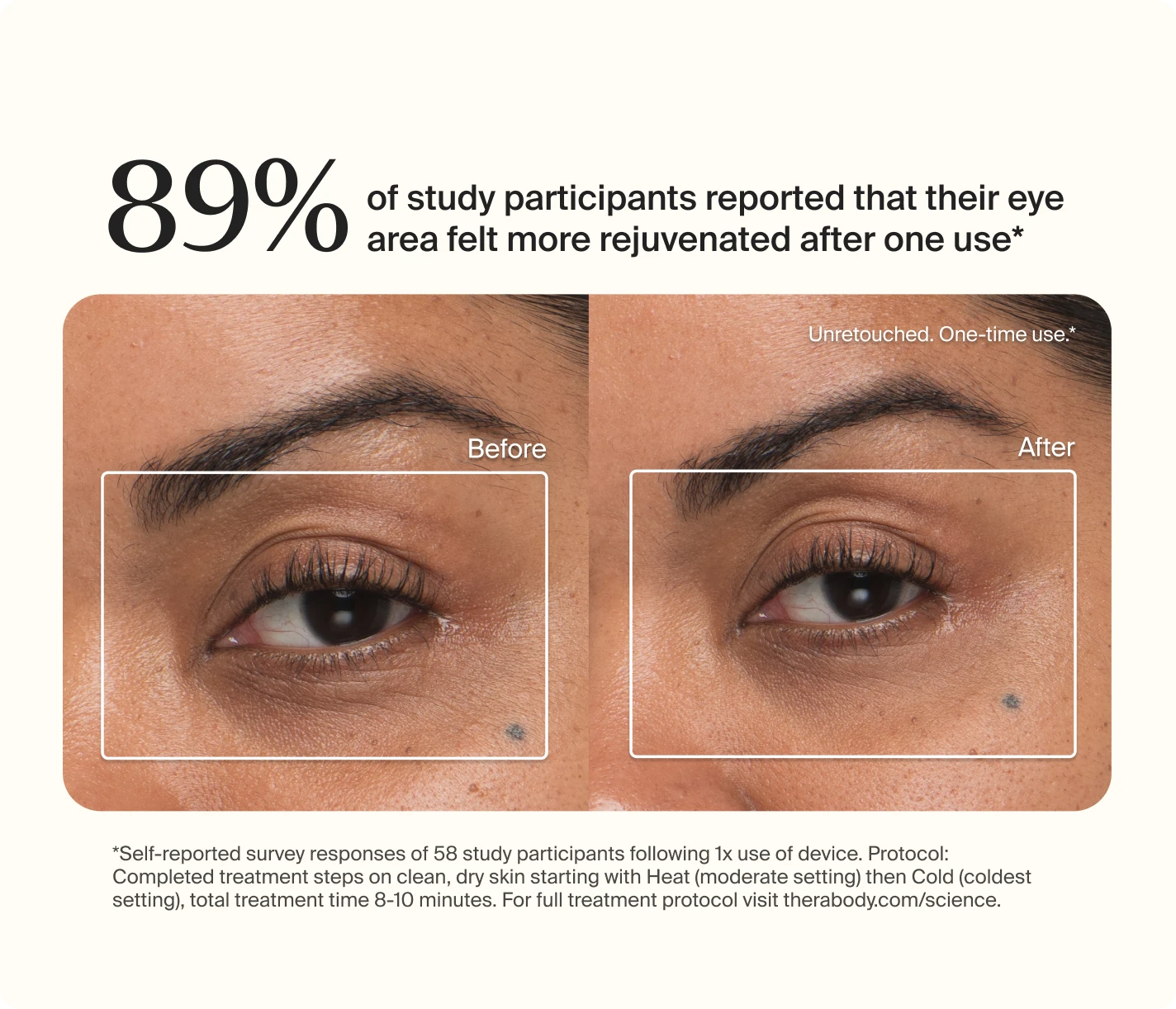 89% of study participants reported that their eye area felt more rejuvenated after one use*. Before/After. *Self-reported survey responses of 58 study participants following 1x use of device. Protocol Completed treatment steps on clean, dry skin starting with Heat (moderate setting) then Cold (coldest setting), total treatment 8-10 minutes. For full treatment protocol visit therabody.com/science.