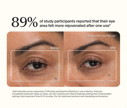 89% of study participants reported that their eye area felt more rejuvenated after one use*. Before/After. *Self-reported survey responses of 58 study participants following 1x use of device. Protocol Completed treatment steps on clean, dry skin starting with Heat (moderate setting) then Cold (coldest setting), total treatment 8-10 minutes. For full treatment protocol visit therabody.com/science.