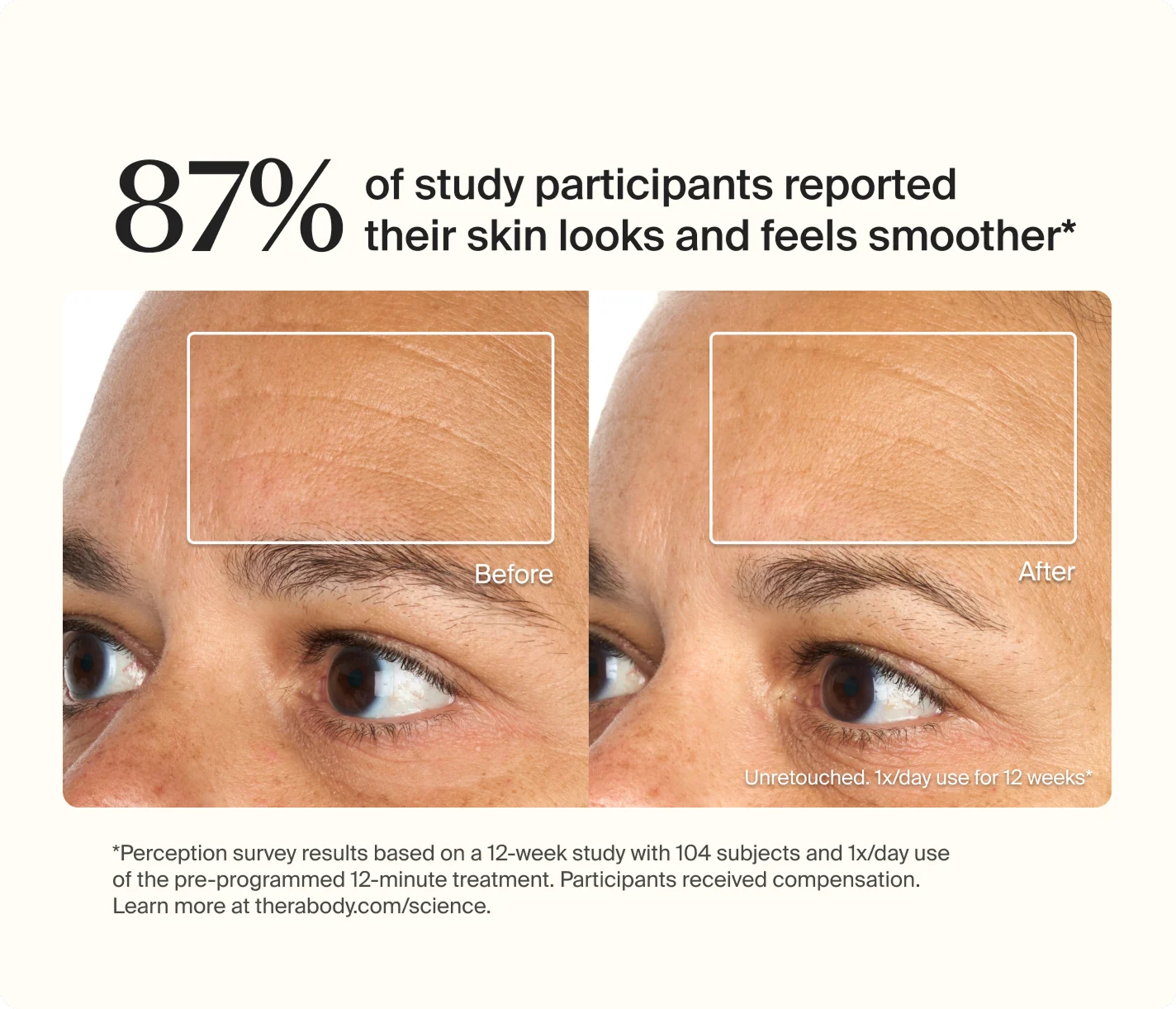 87% of study participants reported their skin looks and feels smoother* | Before | After | Unretouched. 1x/day use for 12 weeks* | *Perception survey results based on a 12-week study with 104 subjects and 1x/day use of the pre-programmed 12-minute treatment. Participants received compensation. Learn more at therabody.com/science.