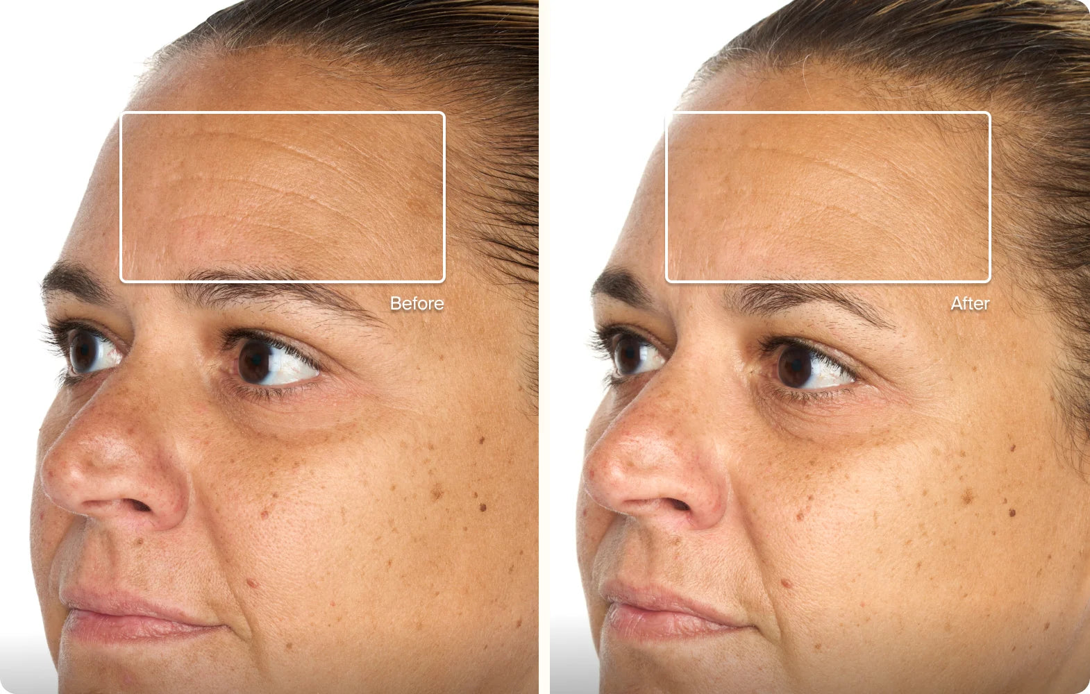 Before and after result