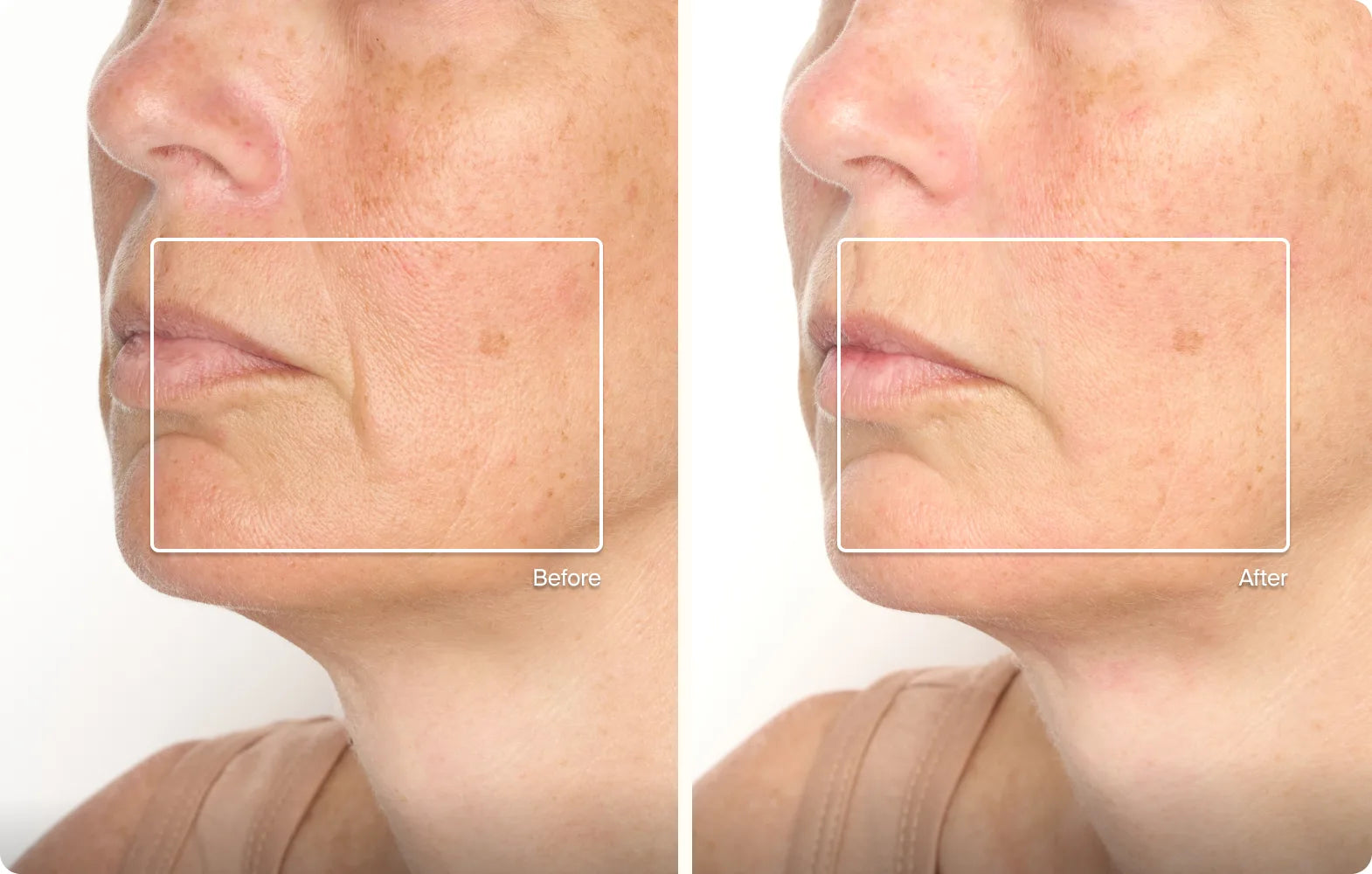 Before and after result