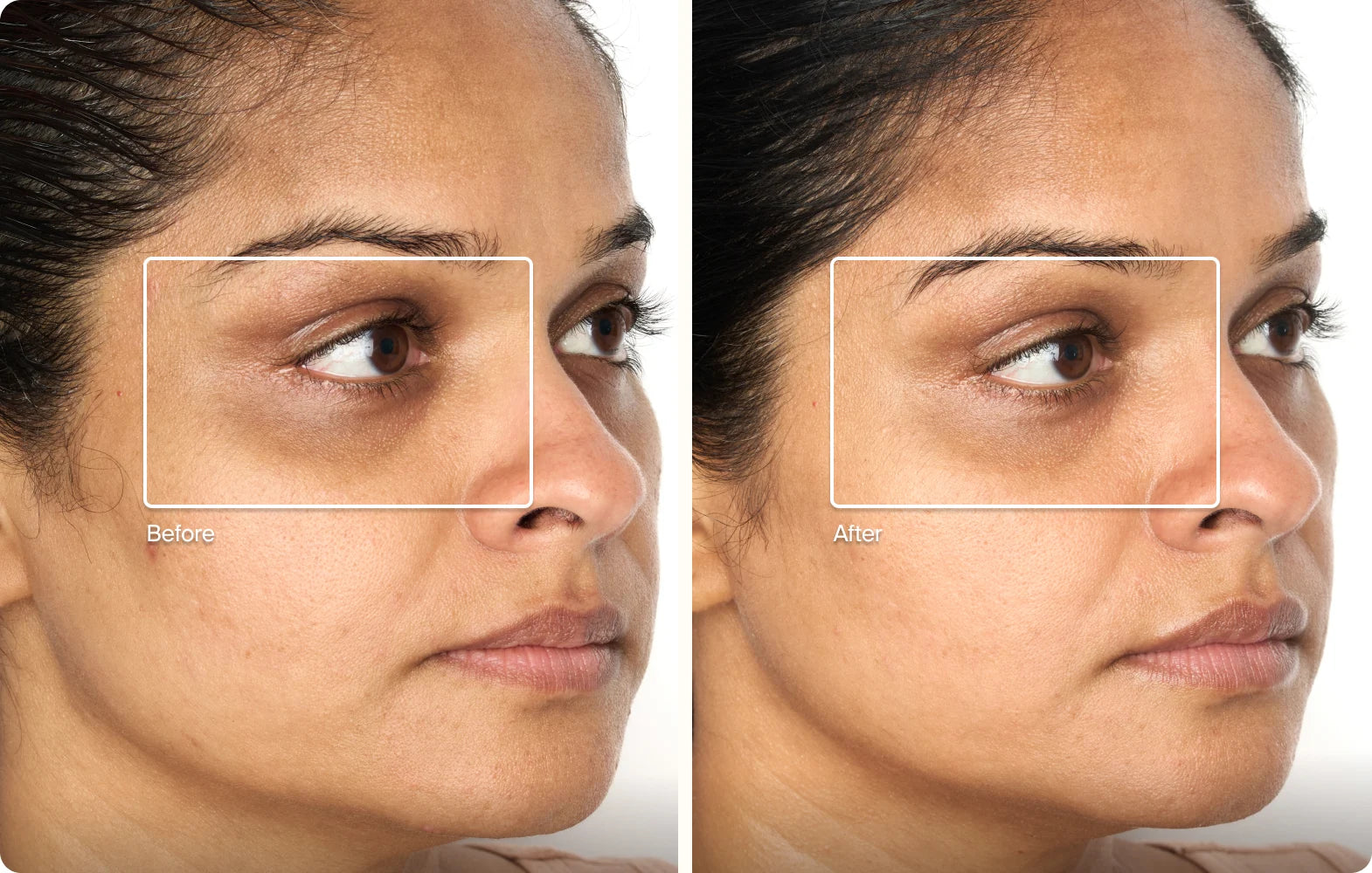 Before and after result